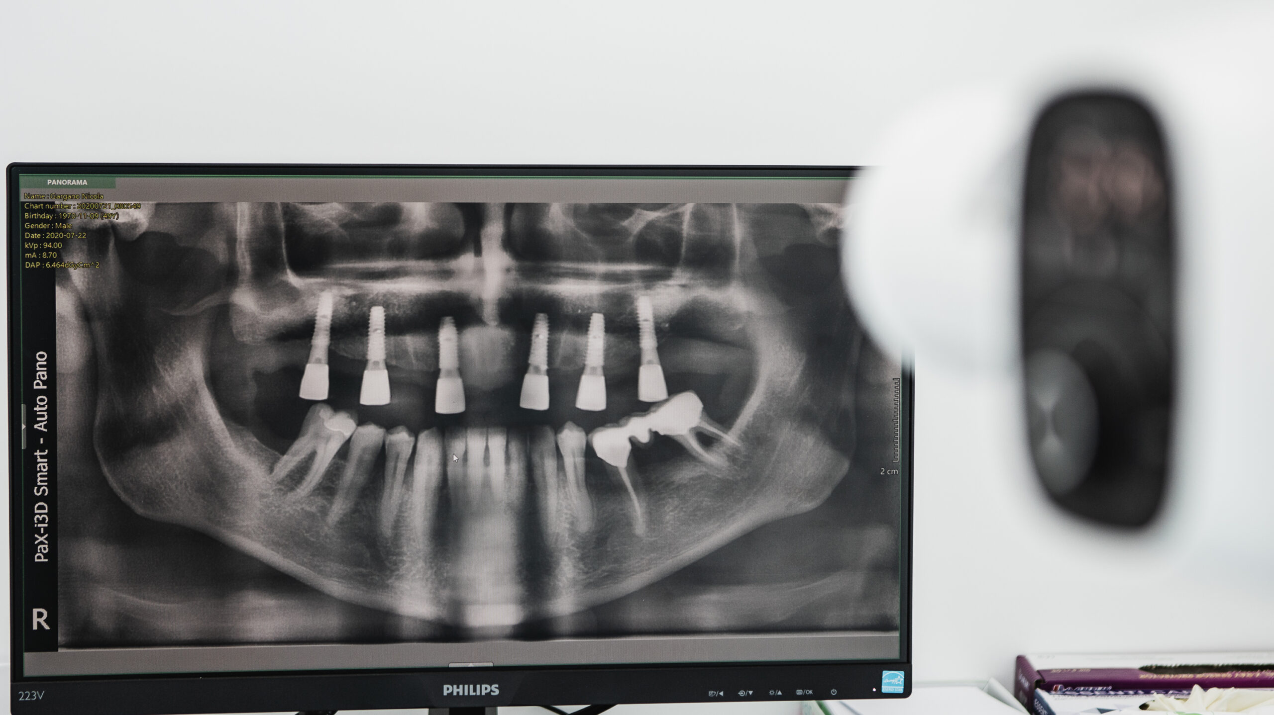 Radiografie panoramică afișată lângă aparatul de imagistică